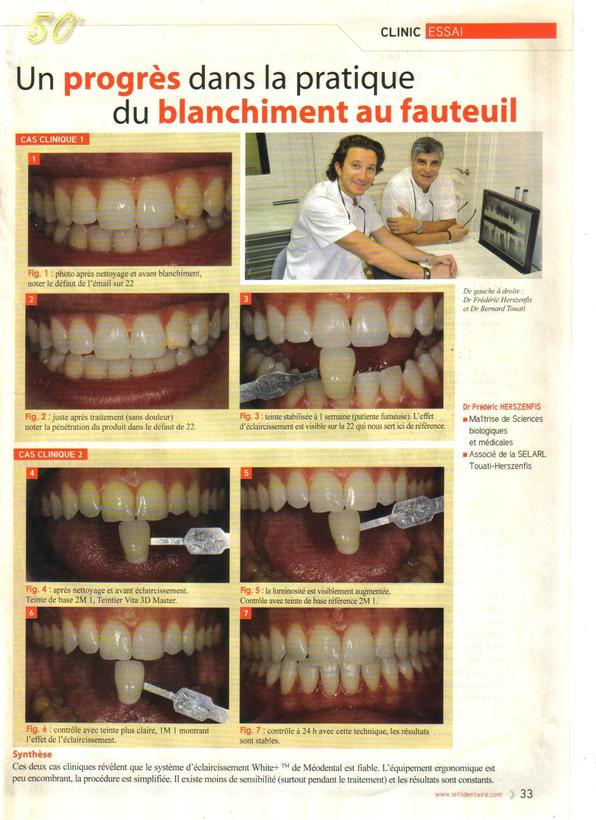 Le blanchiment dentaire en France
